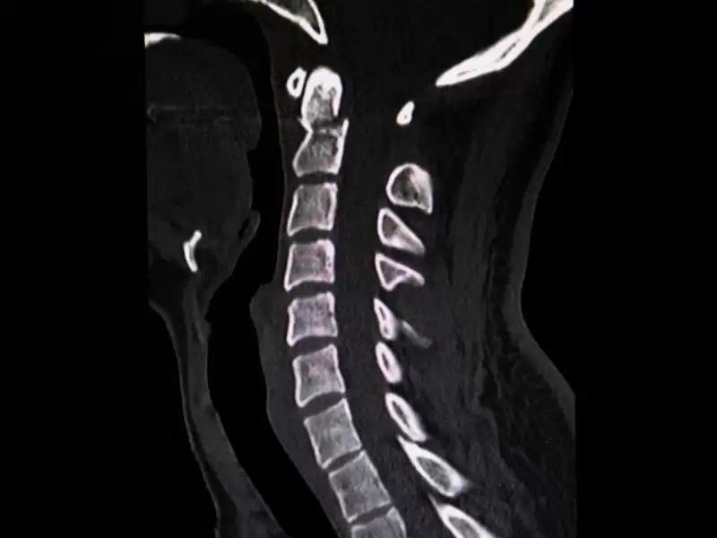 c1-c2-posterior-stabilizasyon-cerrahisi