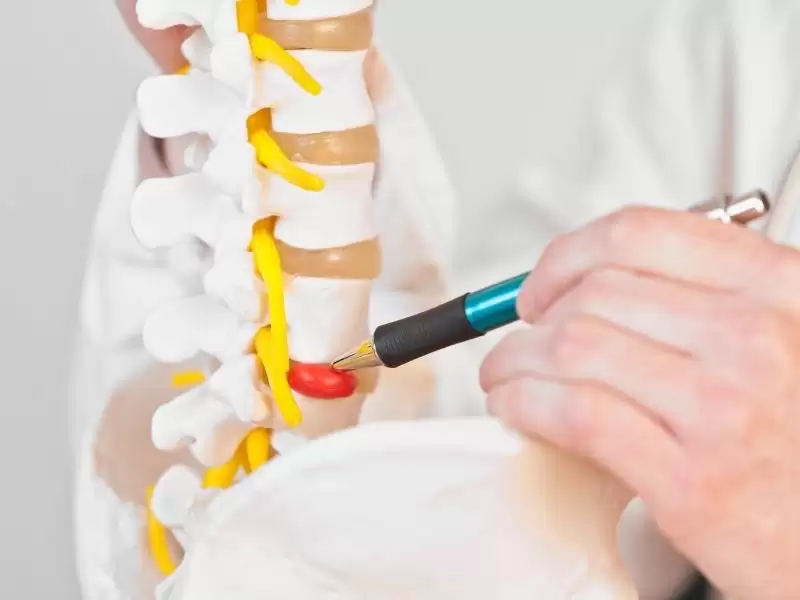 lomber-epidural-enjeksiyon