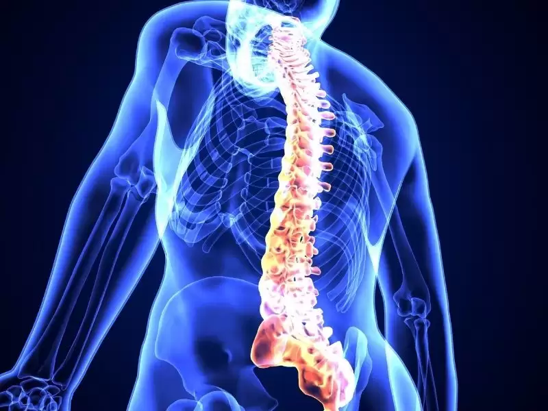 osteoporotik-vertebra-kirigi
